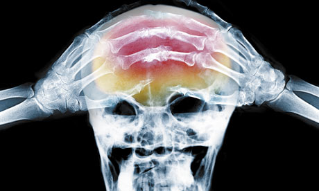 X-ray-of-headache-001